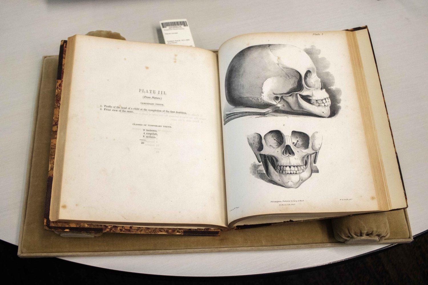 A rare book from the Wangensteen Historical Library shows drawings of the human skull. (Photo/Adria Carpenter)